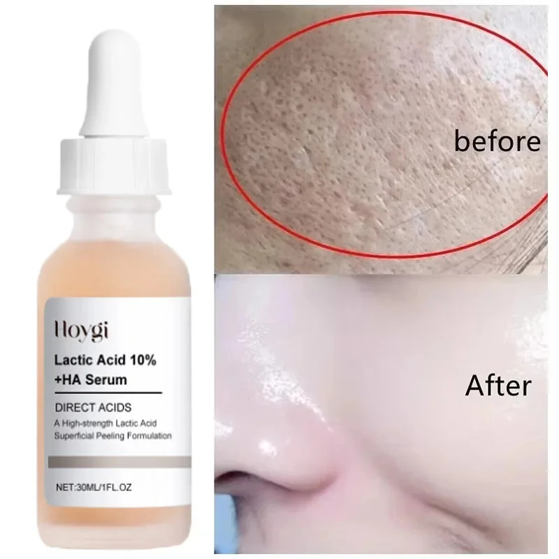 Licorice Root Extract - Lactic Acid Shrink Pores Serum Fast