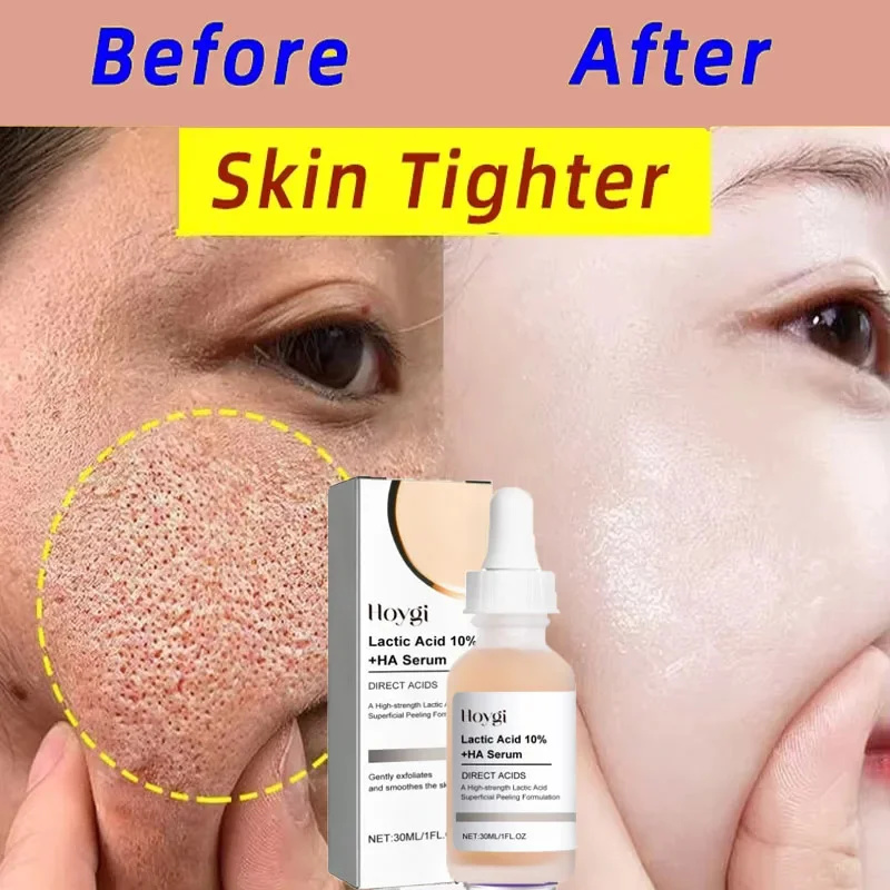 Lactic Acid Shrink Pores Serum - Licorice Root Extract recension och pris