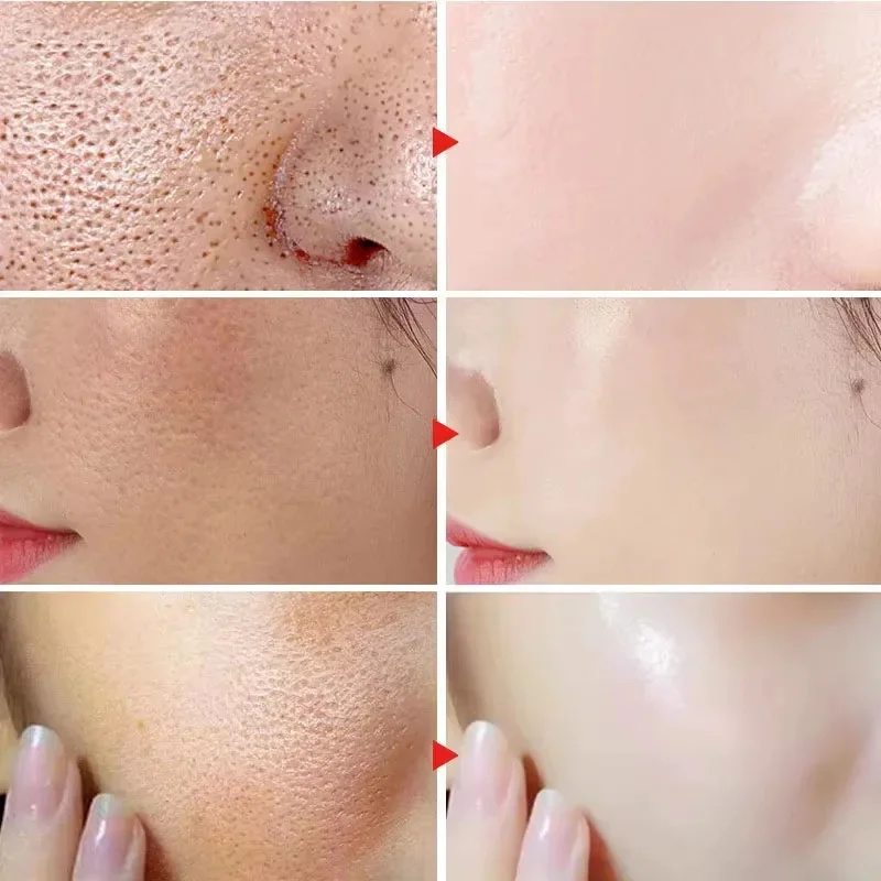 Lactic Acid Shrink Pores Serum - Licorice Root Extract recension och pris