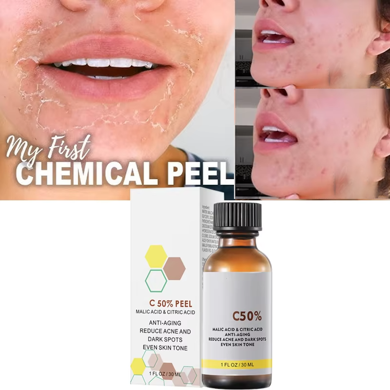 With Malic Acid And Citric Aci - Licorice Root Extract recension och pris