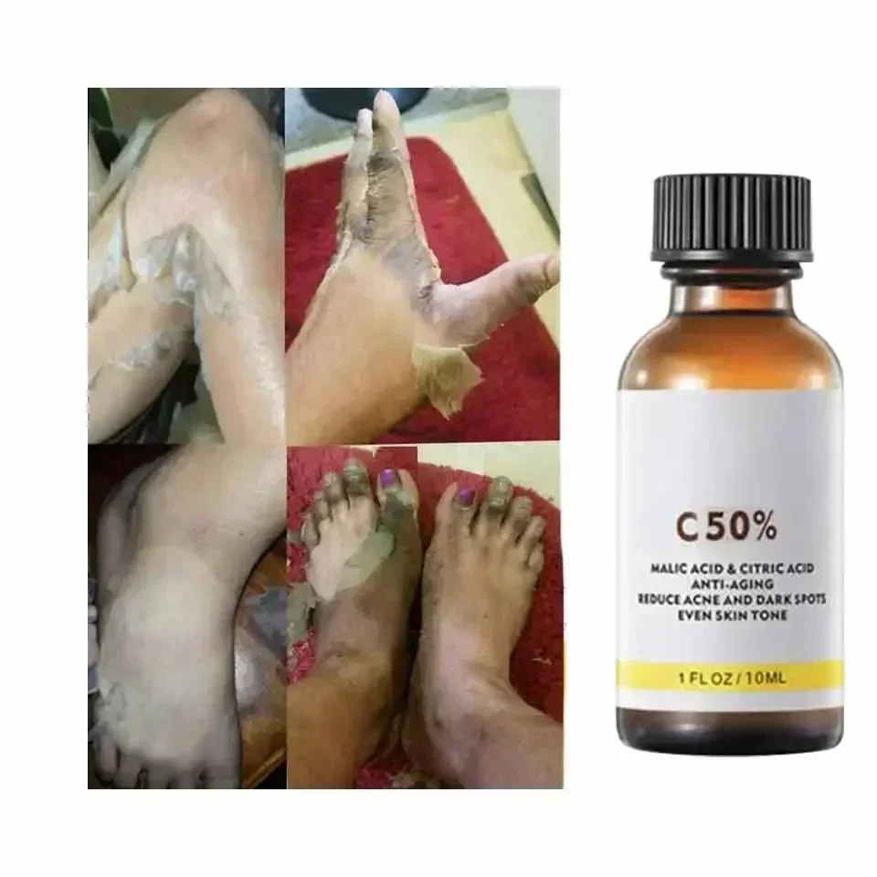 With Malic Acid And Citric Aci - Licorice Root Extract recension och pris